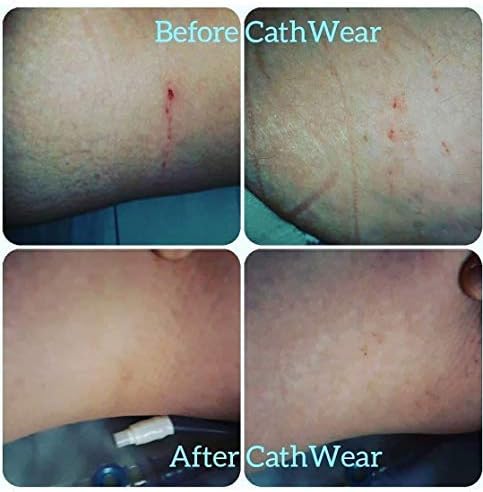 Cathwear Catheter Leg Bag Underwear - Leg Bag Holder for Men & Women| Medicare Approved -Compatible with Foley, Nephrostomy, Suprapubic & Biliary Catheters Holds (2) 600ml Leg Bags | Black | XXXL